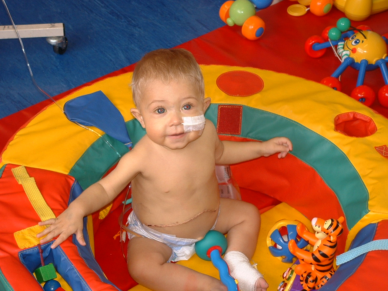 Evan had a liver transplant before his first birthday.