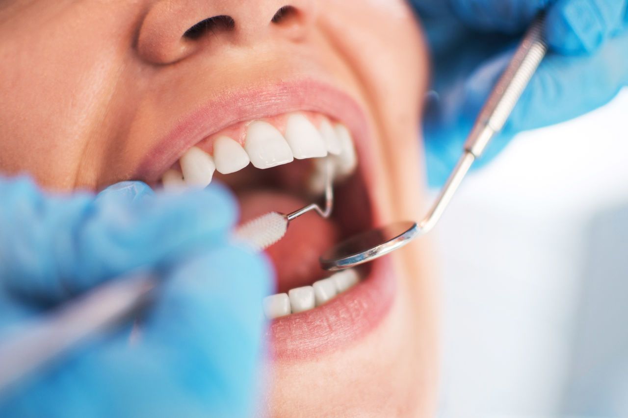 Third of registered patients in Scotland did not see NHS dentist for three years