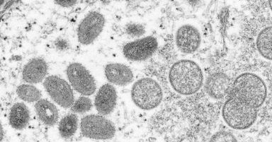 New monkeypox guidance tells close contacts to isolate for 21 days