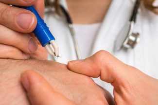 NHS 24 release advice on tick bites following an increase in calls
