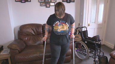 One in three Scots living with a neurological condition waiting over a year for diagnosis