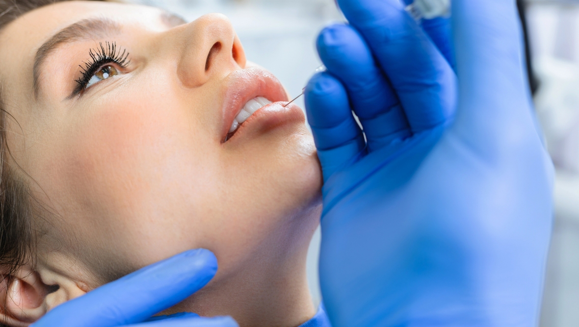 Lip fillers and Botox face tighter restrictions after Scottish Government consultation to regulate procedures
