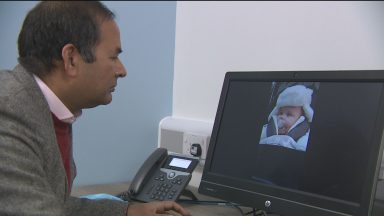 Baby diagnosed with epilepsy from video of symptoms