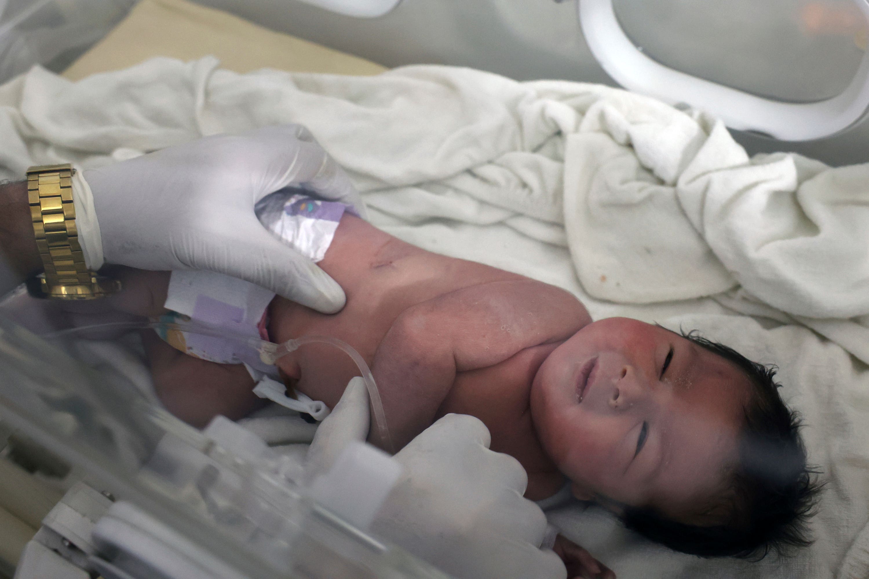 A baby girl who was born under the rubble caused by an earthquake that hit Syria and Turkey receives treatment inside an incubator at a children’s hospital in the town of Afrin, Aleppo province, Syria, Tuesday, Feb. 7, 2023. Residents in the northwest Syrian town discovered the crying infant whose mother gave birth to her while buried underneath the rubble of a five-story apartment building levelled by this week’s devastating earthquake, relatives and a doctor say. 