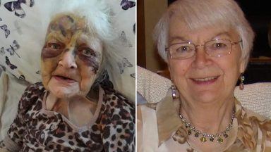 Abseiling granny Nancy Donnelly found with ‘horrific bruises’ before death in Broomfield Court Care Home