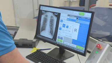 New £48m eye and orthopaedic centre opens in Inverness