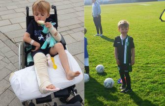 East Lothian schoolboy ‘defies all odds’ to walk again after being hit by car at four years old