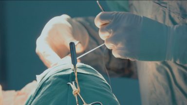 Doctors warn against travelling abroad for operations