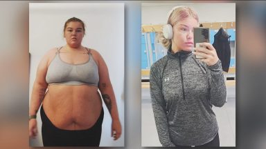 Young mum left screaming in pain after botched Turkey surgery