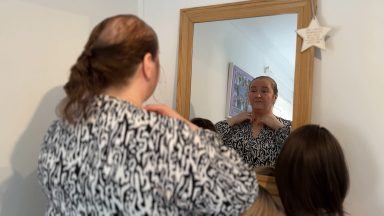 Scottish woman campaigns for NHS to provide wigs for those diagnosed with alopecia