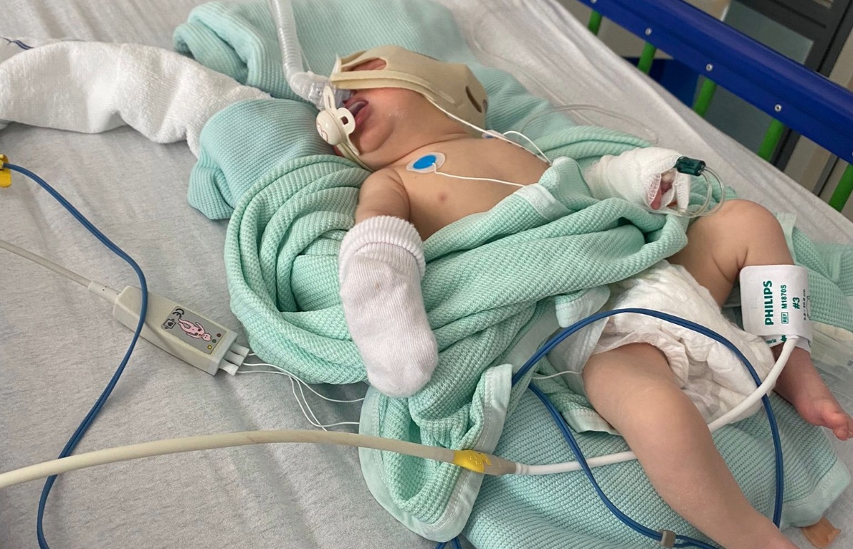 Jackson was put on a ventilator at just three-weeks-old