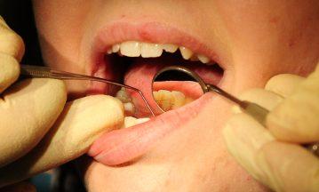 Labour warns Scotland facing two-tier dentistry system
