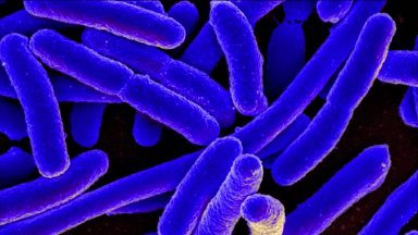 Concerns as cases of potentially deadly E.coli surge across Scotland