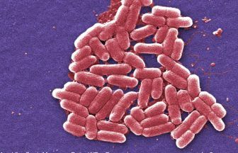 ‘Decline’ in E. coli outbreak as half of cases admitted to hospital amid warning