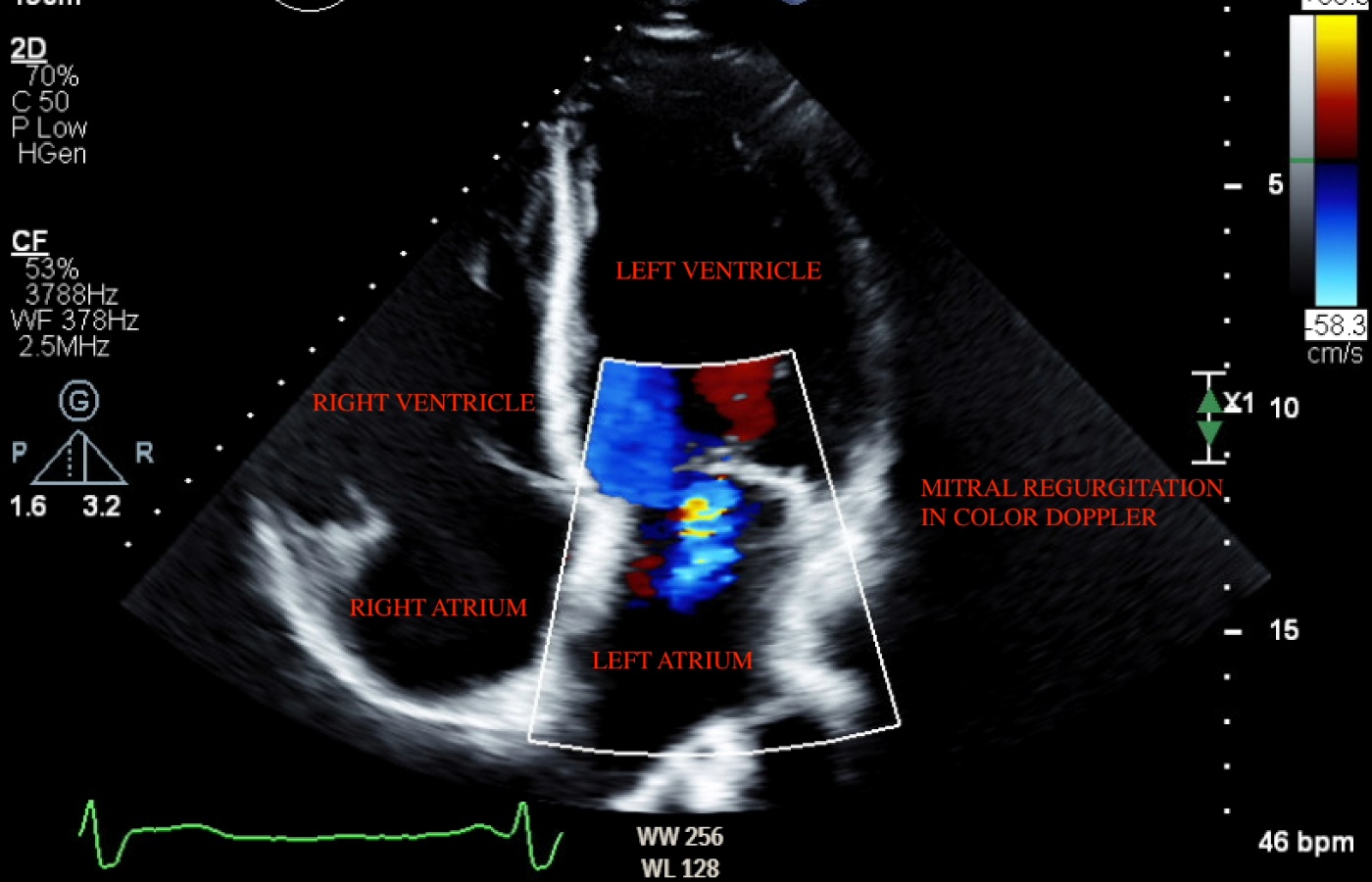 The pilot project saw the team develop software capable of quickly and accurately scanning heart echo images (ultrasound scans) and other medical data (University of Dundee/PA) 