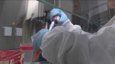 Study hoping to find new treatments for endometriosis