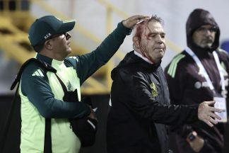 Honduras handed supporter ban after Mexico boss Javier Aguirre hit by beer can