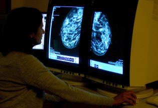 Cancer risk among women under 50 rising, figures show