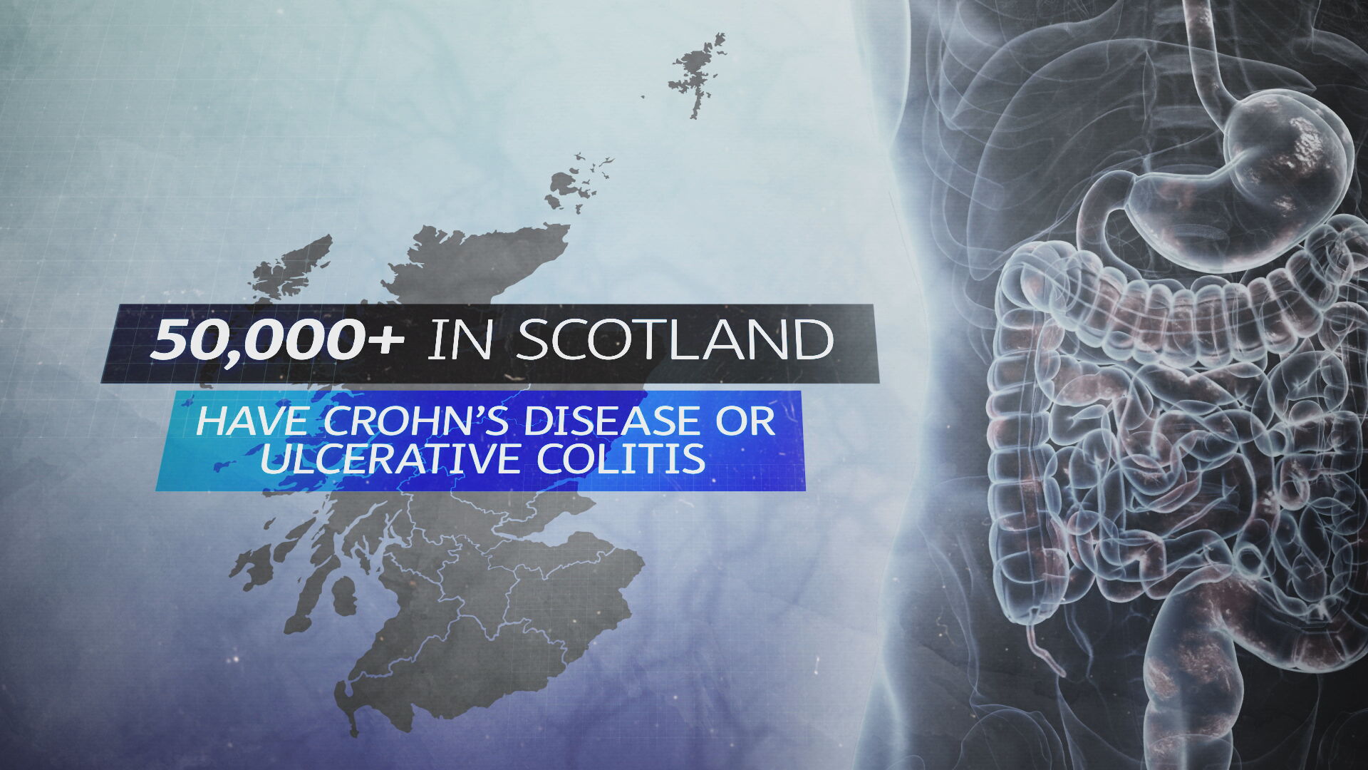 The condition affects thousands of people in Scotland