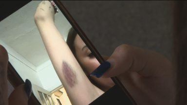 Woman attacked by teens backs calls for more youth services