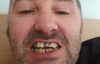 Edinburgh comedian launches funding appeal to replace front teeth after alleged pub attack