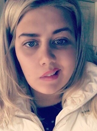 Amber was diagnosed with Bell's Palsy in 2018