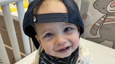 Baby with ‘squint’ in his eye diagnosed with aggressive rare cancer bilateral retinoblastoma