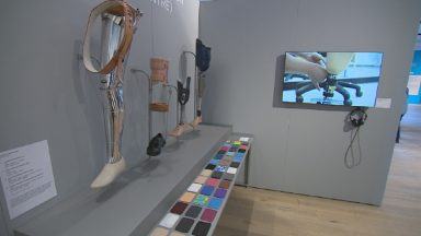 New display examines medical evolution at Tayside’s biggest hospital