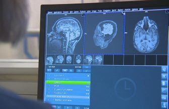 Alzheimer’s research suffers ‘devastating blow’ after new drug rejected by NHS
