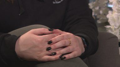 Aberdeen woman shares experience of Polycystic Ovary Syndrome