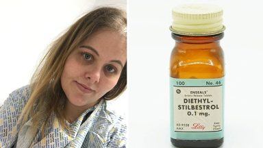 Scots mum diagnosed with cancer after pregnancy drug DES given to grandmother
