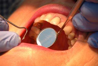 Labour claim Scotland’s dental services ‘wobbling’ under the SNP