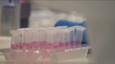 Common medication could help kids with rare disorder
