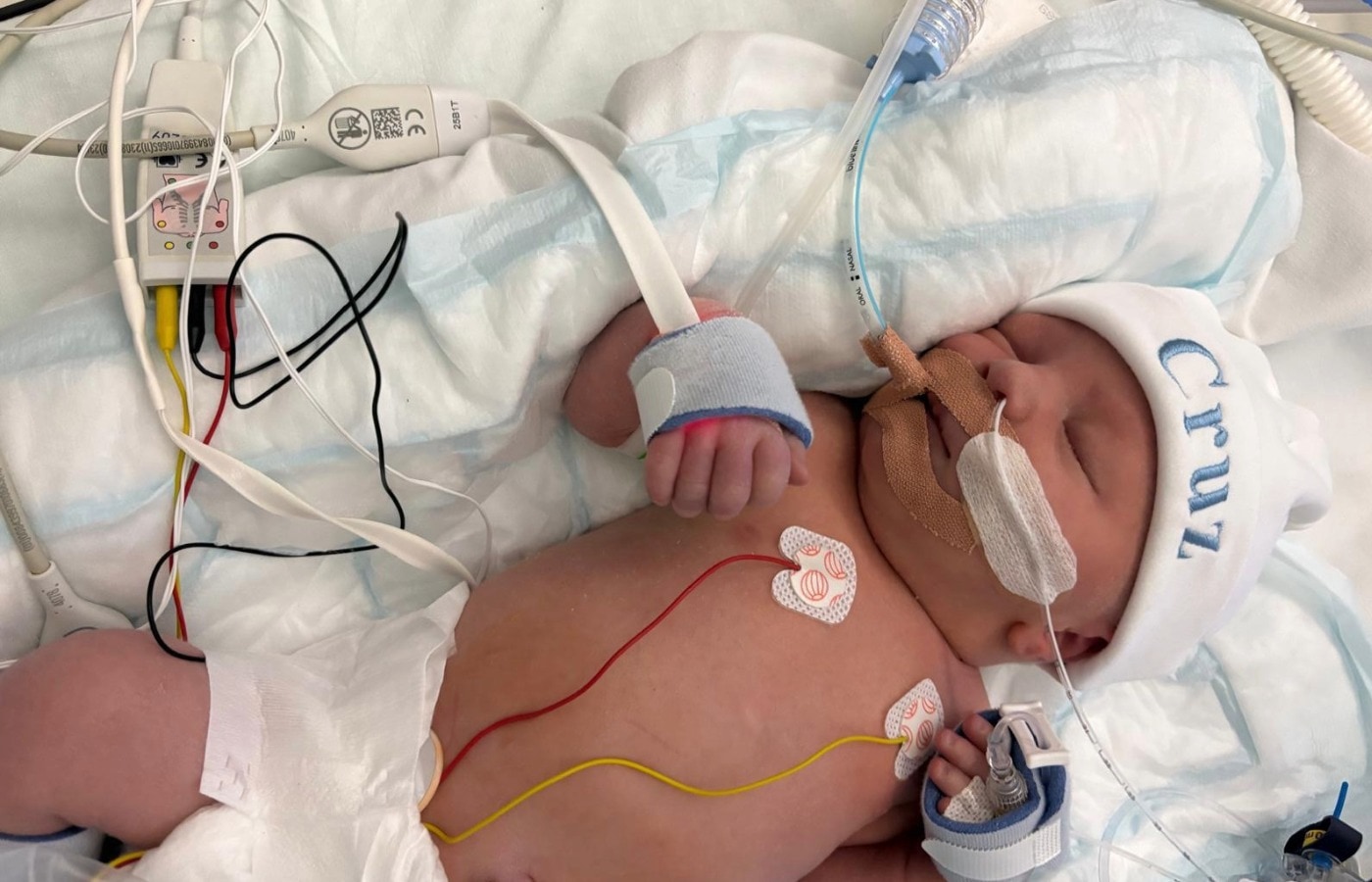 Cheryl Diffin's son, Cruz, found out her baby had a heart condition at her 20-week scan in April, and was told he would need surgery shortly after his birth on August 11.
