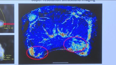 Decision not to offer prostate cancer screening a ‘missed opportunity’
