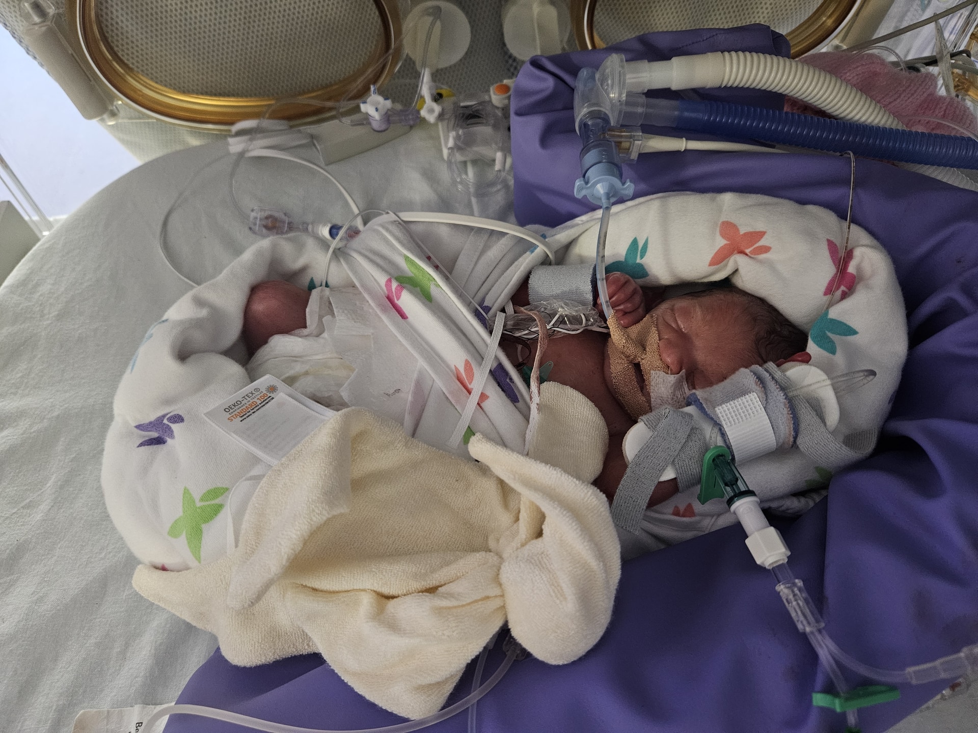 Alexandria spent three months in hospital before she was strong enough to go home.