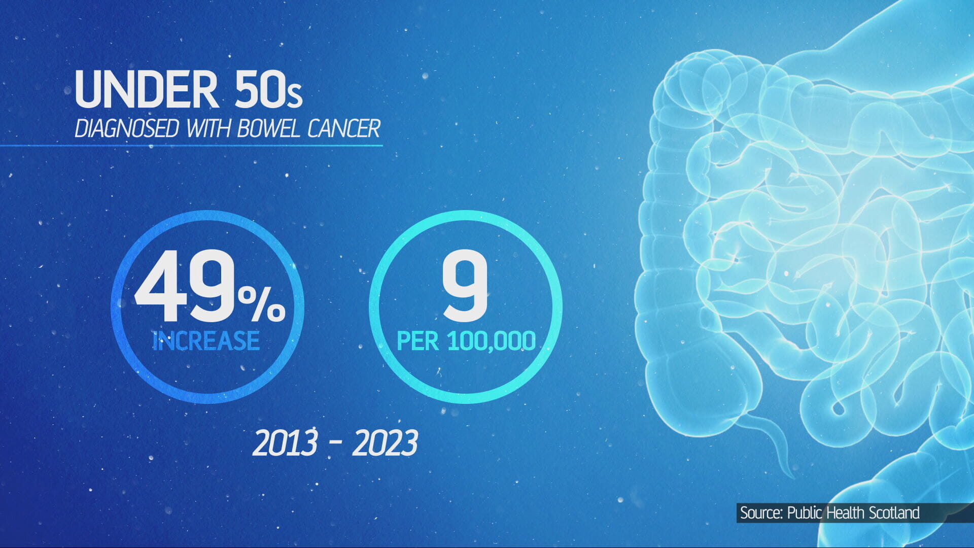 Bowel Cancer gfx.