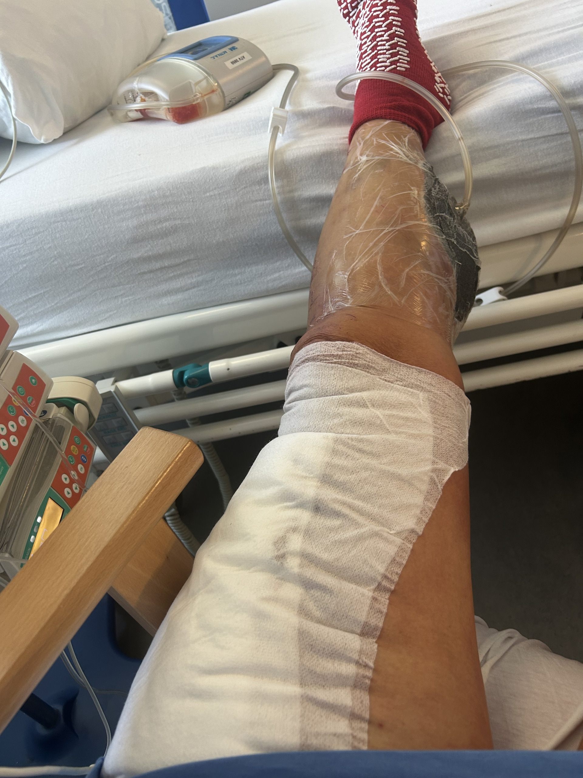 Mary-Jane suffered extensive injuries