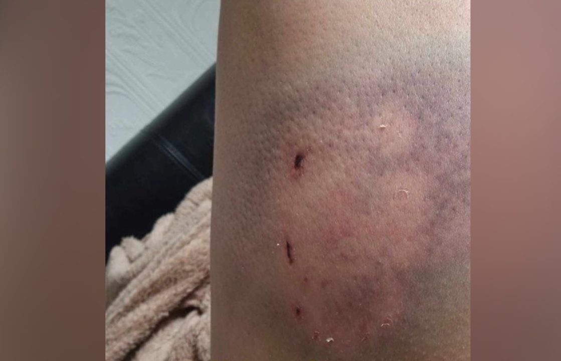 Person ‘attacked’ by two large dogs in Glasgow as police launch investigation