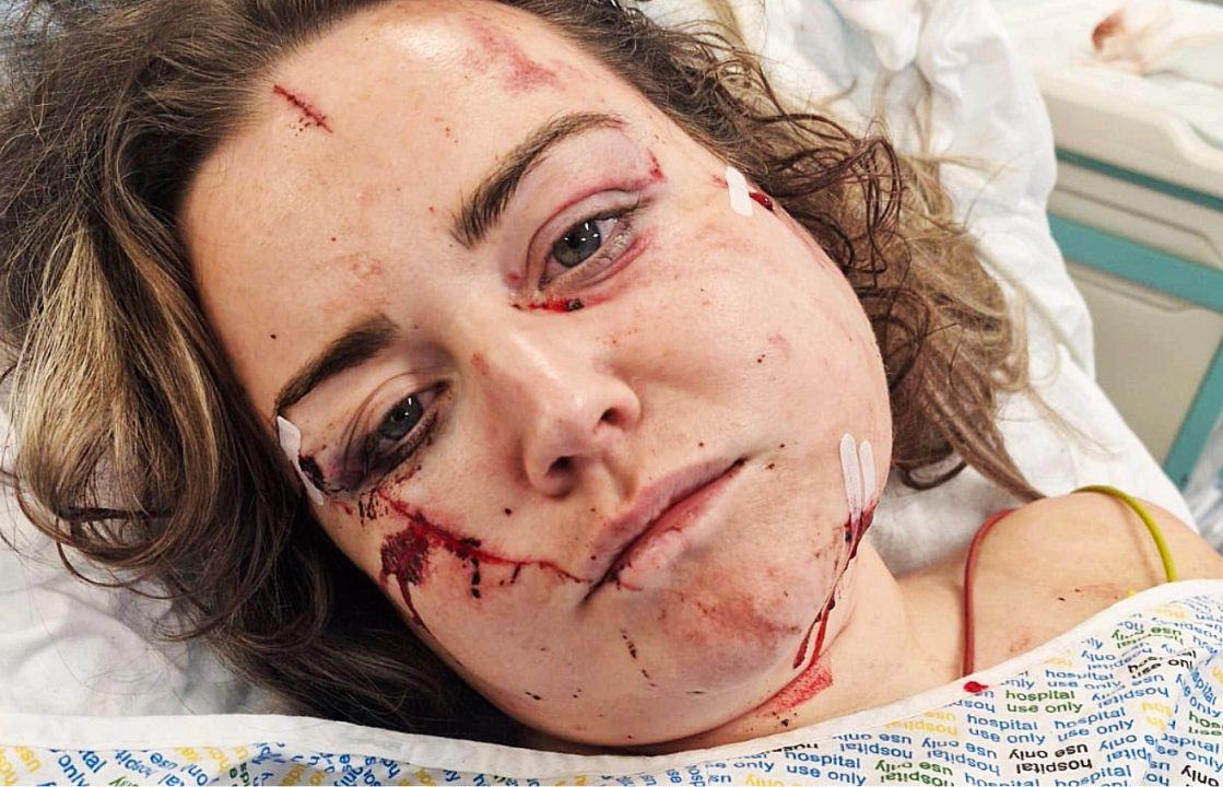 Man attempted to murder ex with dance trophy and kitchen knife