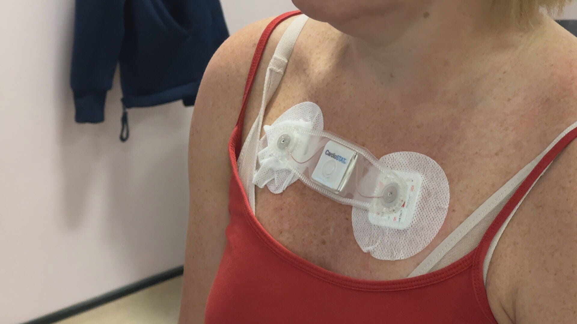 The patches monitor heart rate continuously for 14 days