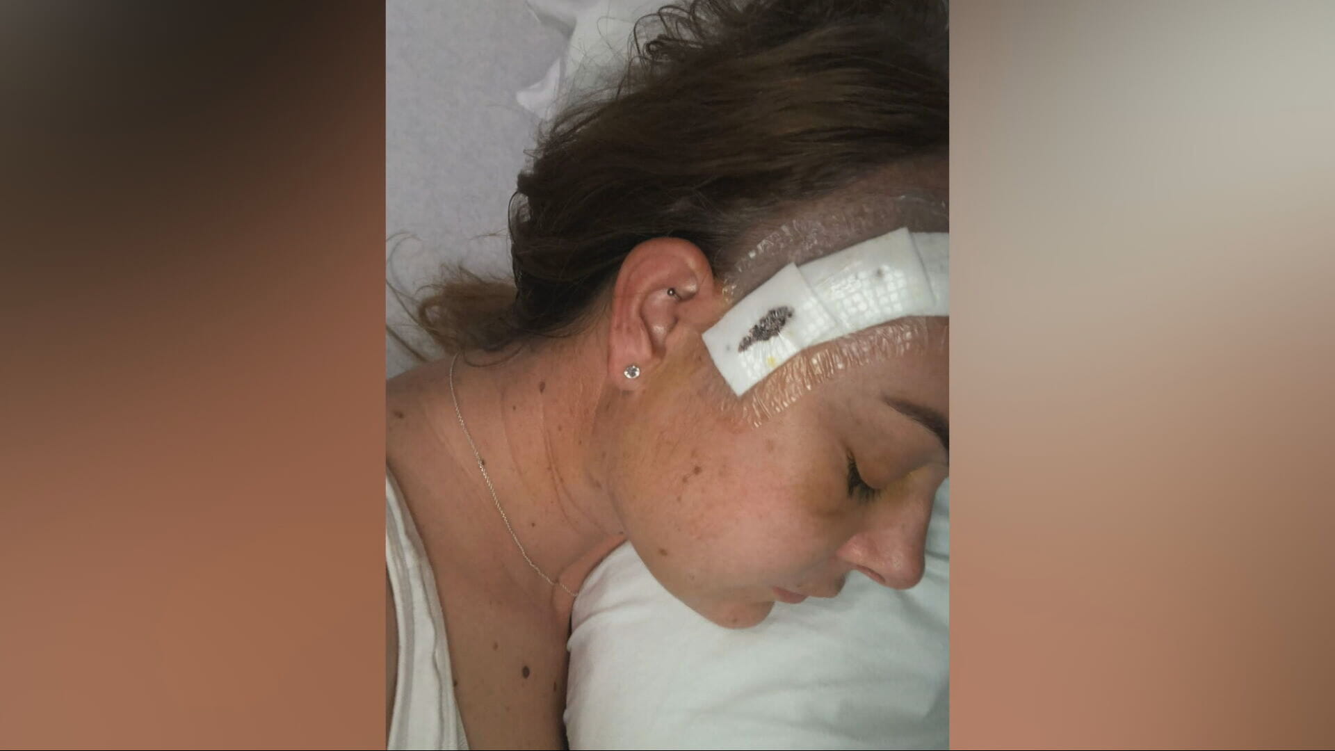 Tammy Croston lost part of her eyesight during surgery.