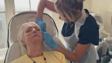 New cosmetic treatment law could push procedures ‘underground’