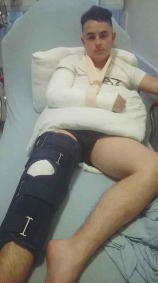 Fraser Girvan was left with a broken arm and torn quad following the crash