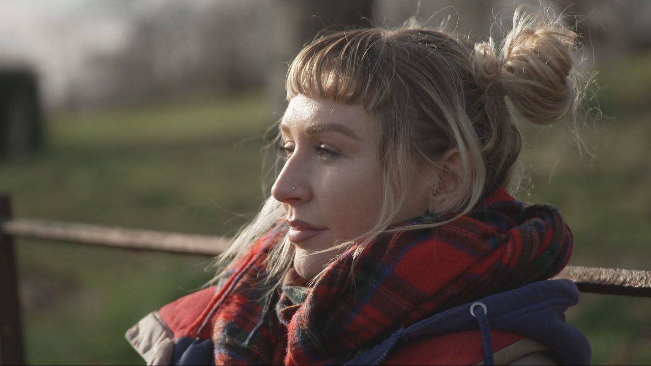 The rise of skin cancer: ‘I was hooked on sunbeds – I never imagined melanoma at 24’