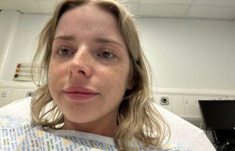 Woman who was taking ketamine every day at height of addiction raising funds for Aberdeenshire support groups