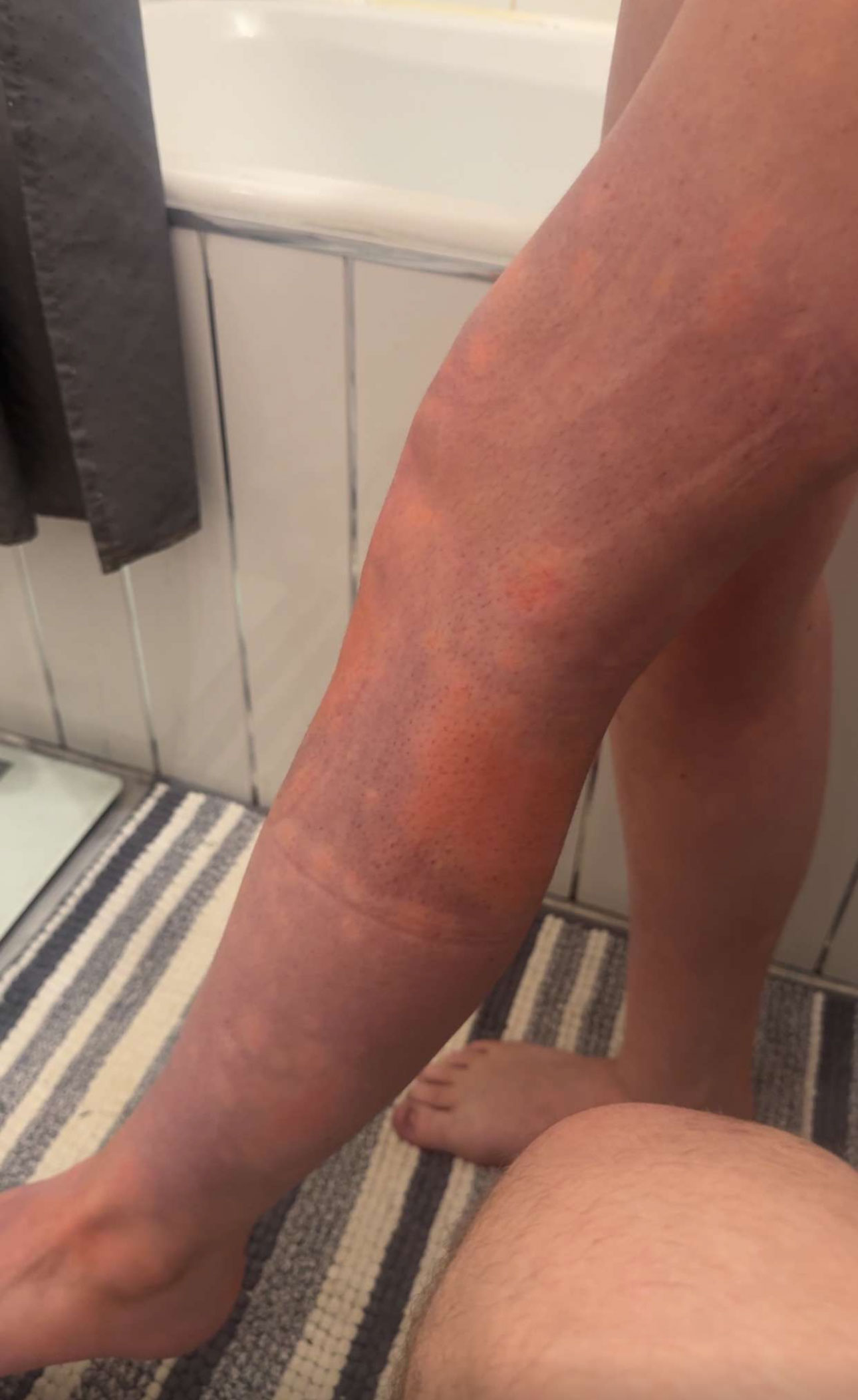 Jessica Gatherer was injured at TRNSMT festival