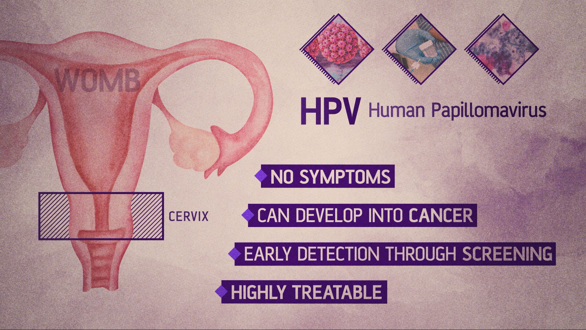 HPV can lead to cancer developing over time