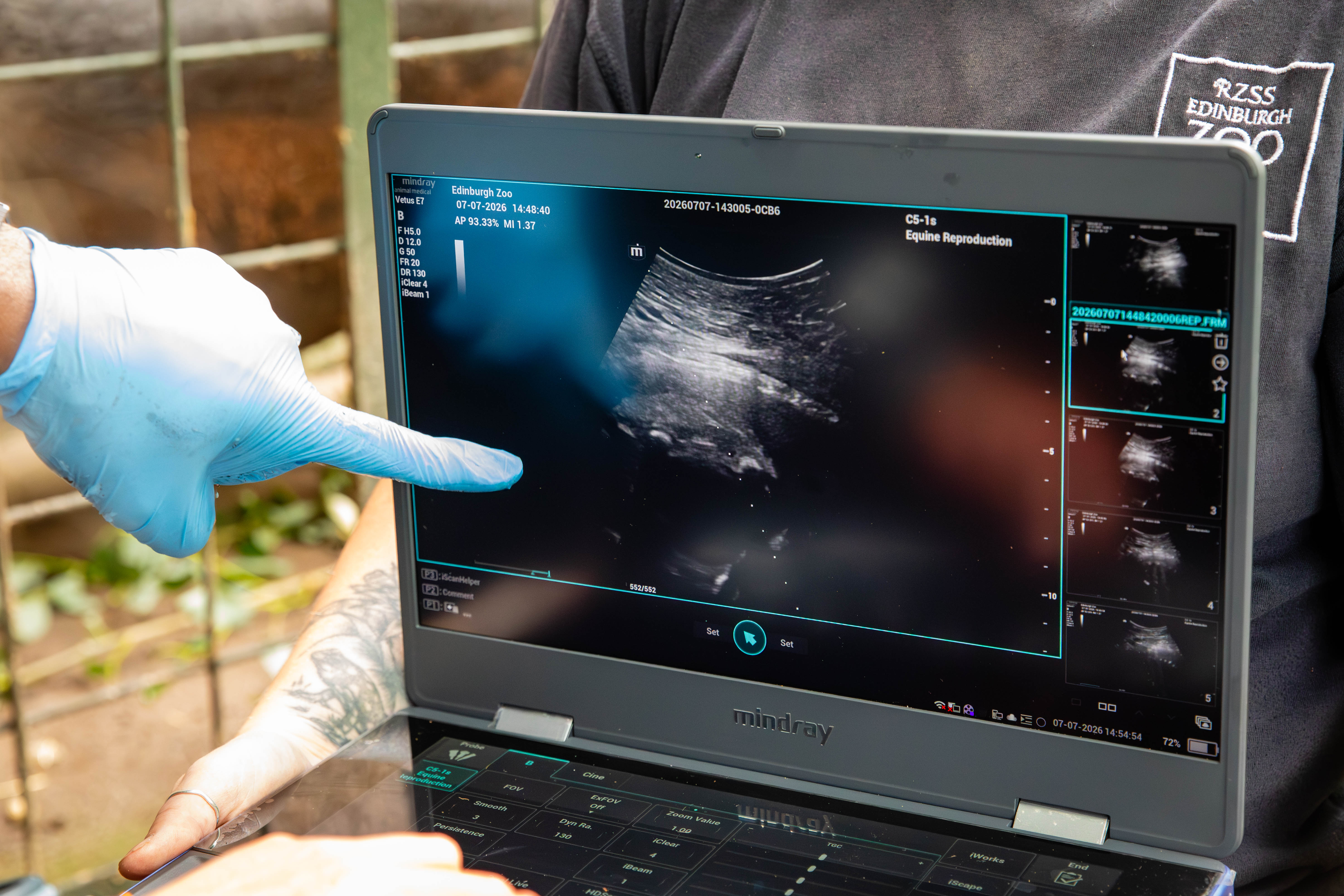 Gloria's ultrasound scan