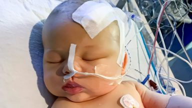 Mother tells how nail infection led to diagnosis of baby son’s brain tumour